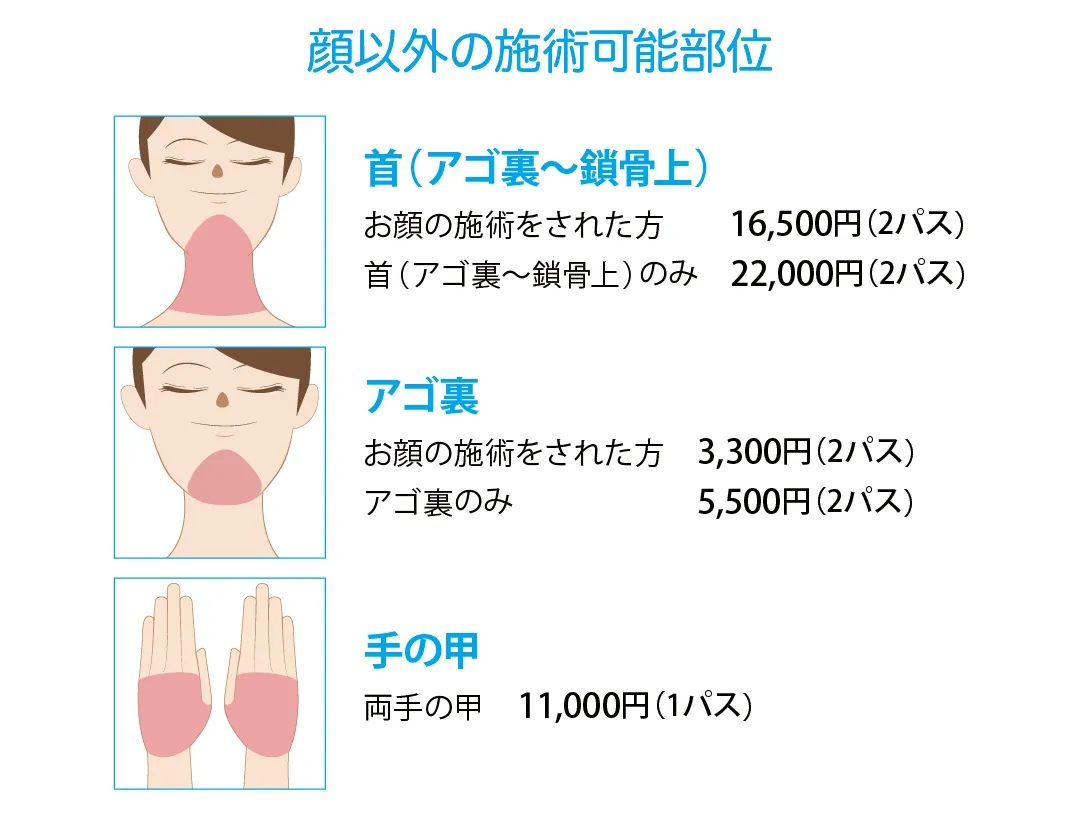 ステラM22照射可能部位